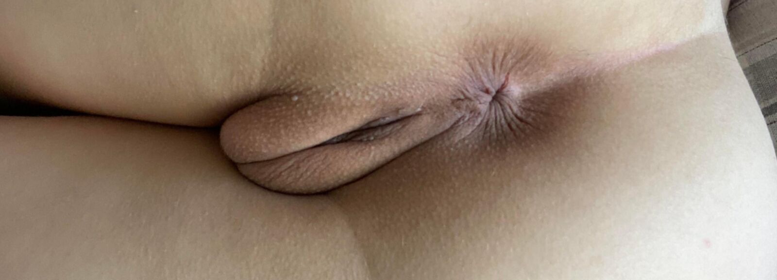 anus