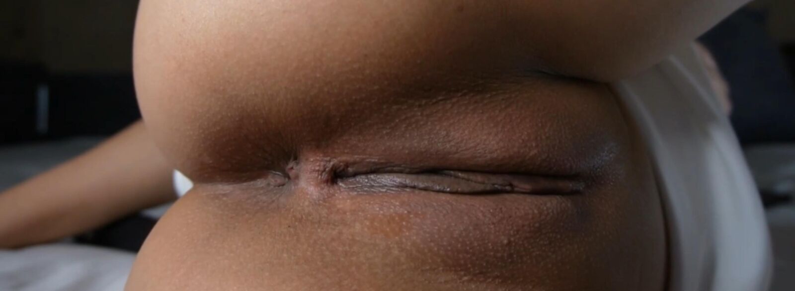 anus