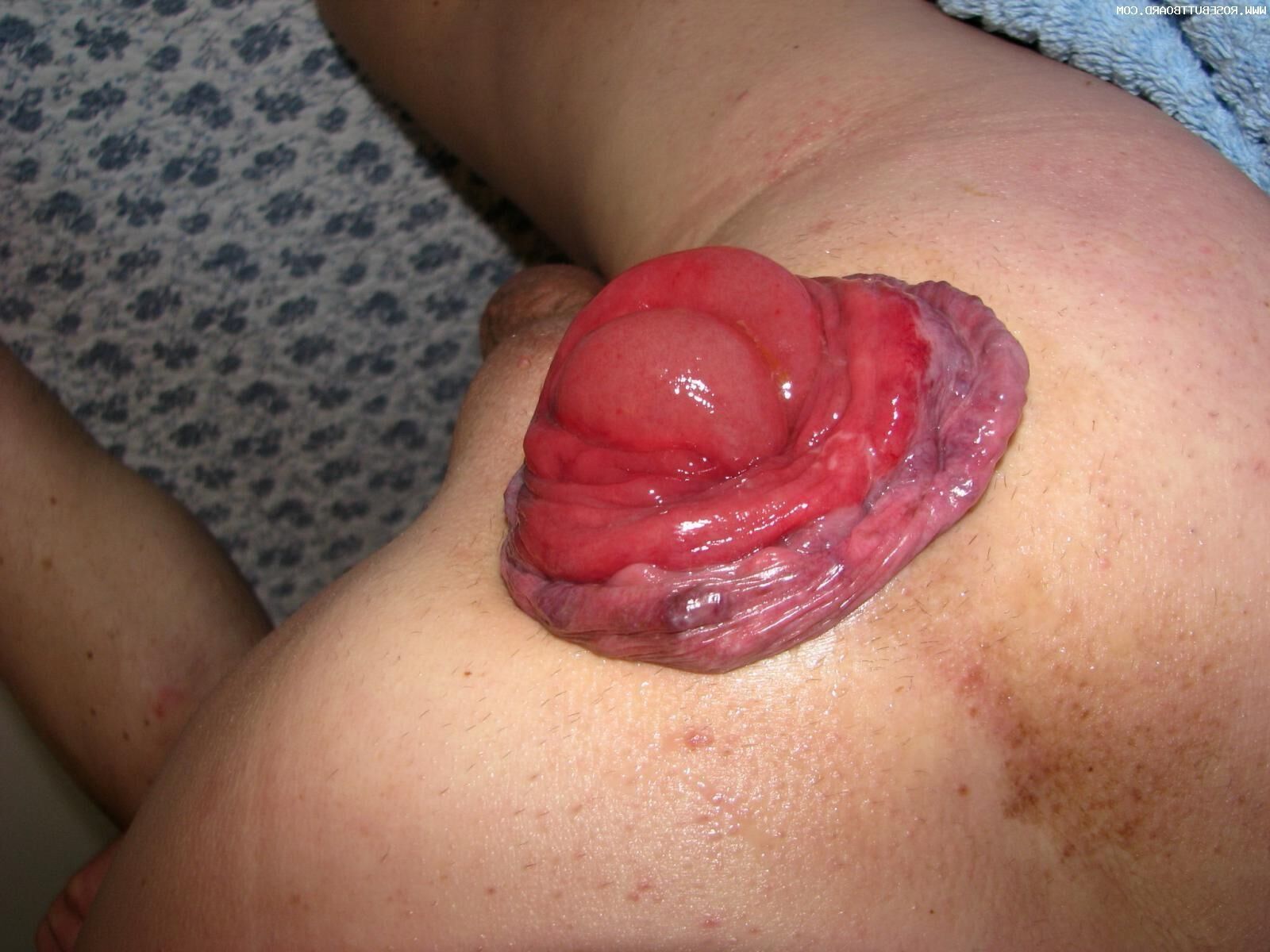 In search of the perfect prolapse