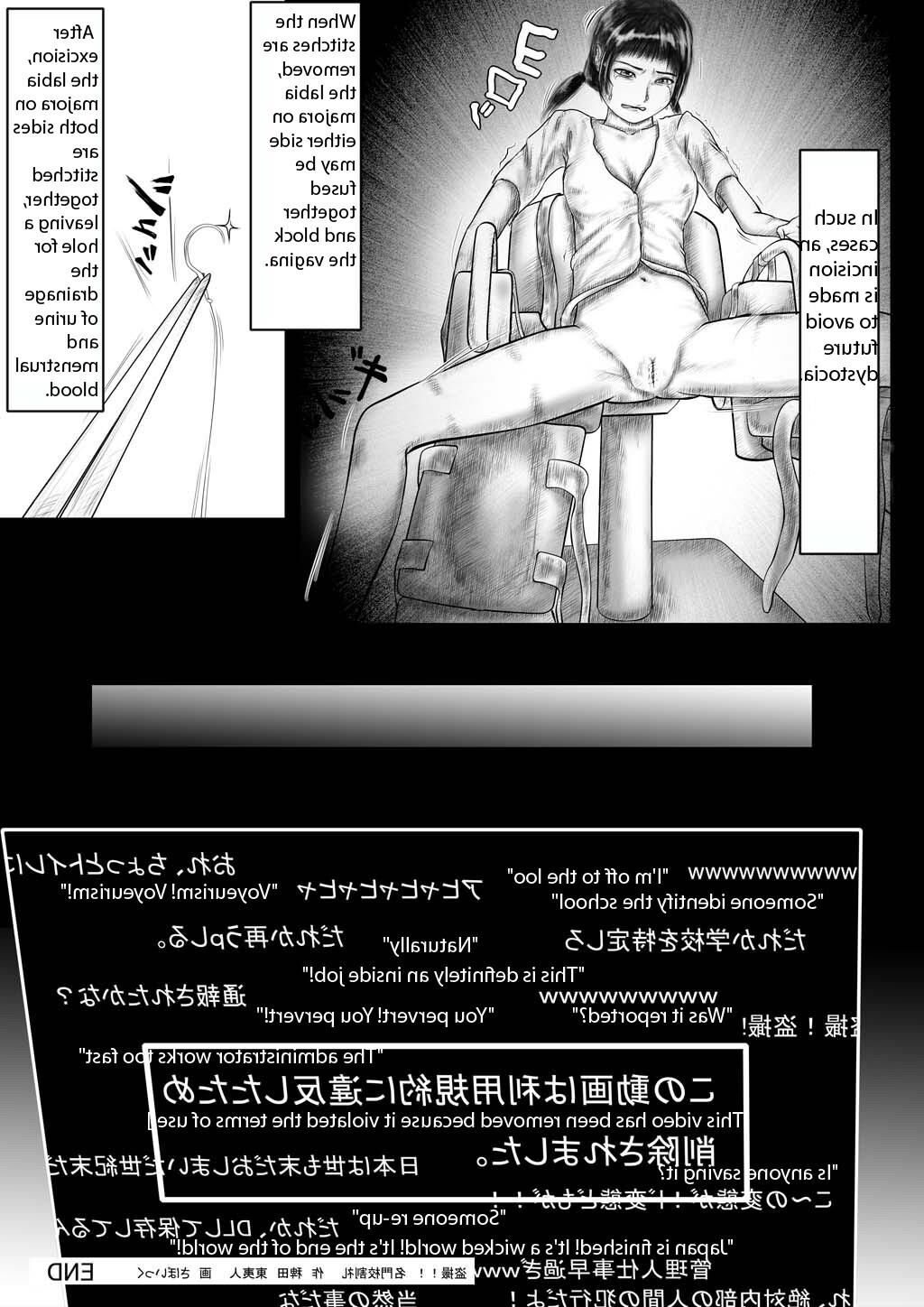 ストーリーを作成する有名な学校の割礼