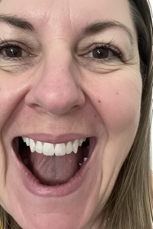 Excited Middle Aged Women (by request)