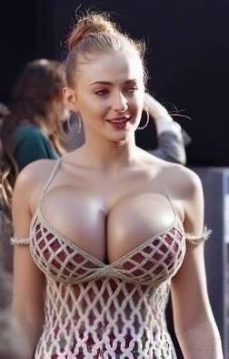 Расширение груди знаменитостей