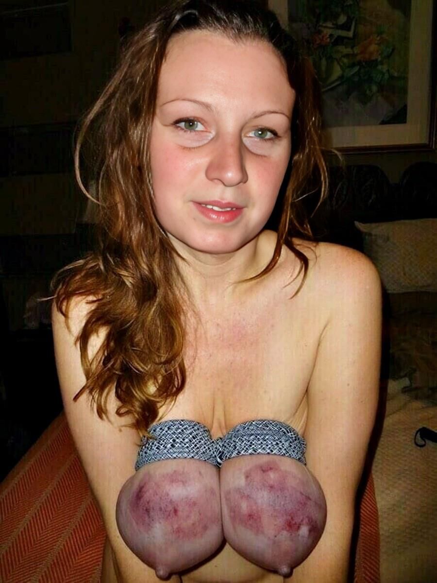 Missbrauchsopfer Bianca 