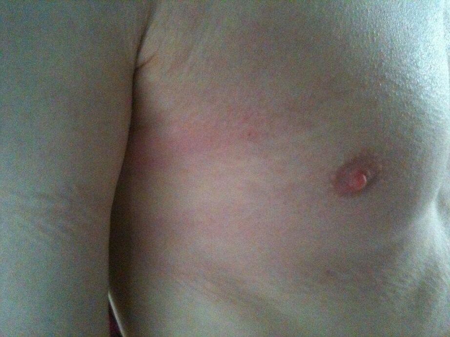 Algunos hombres de dolor