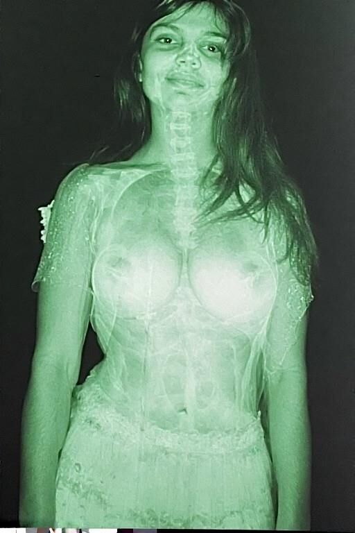 X Ray