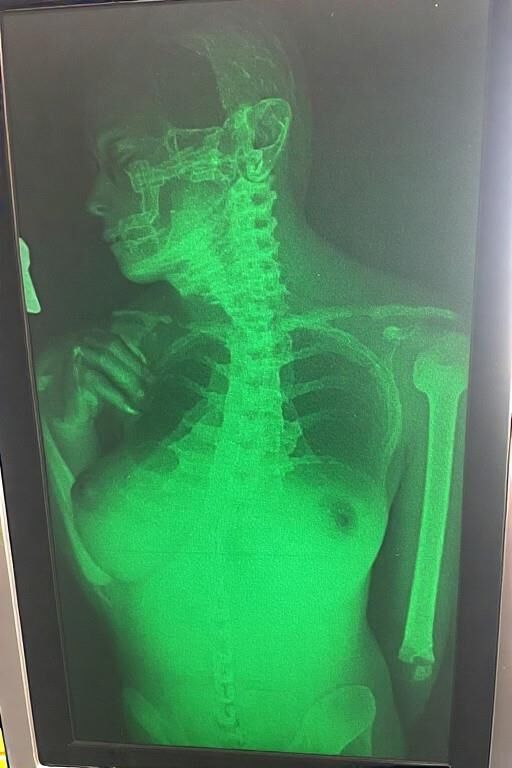 X Ray