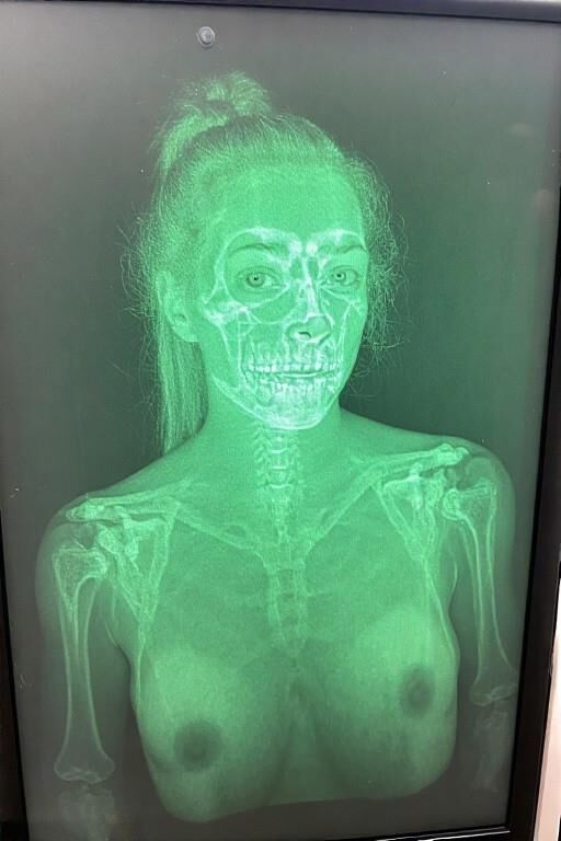 X Ray