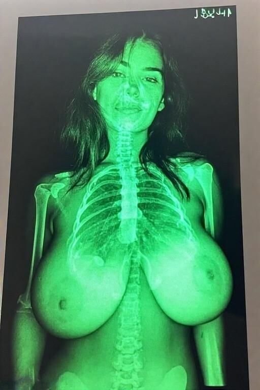 X Ray