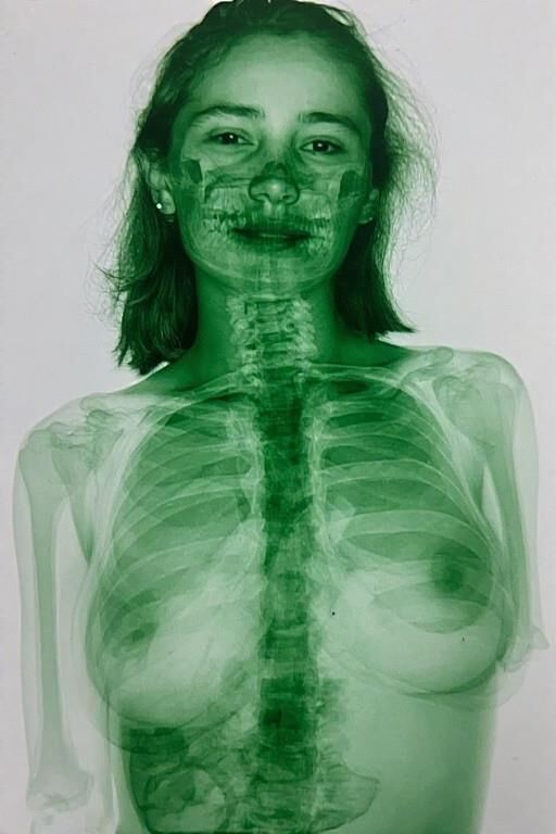 X Ray