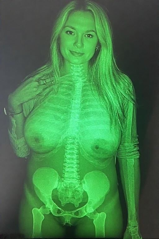 X Ray