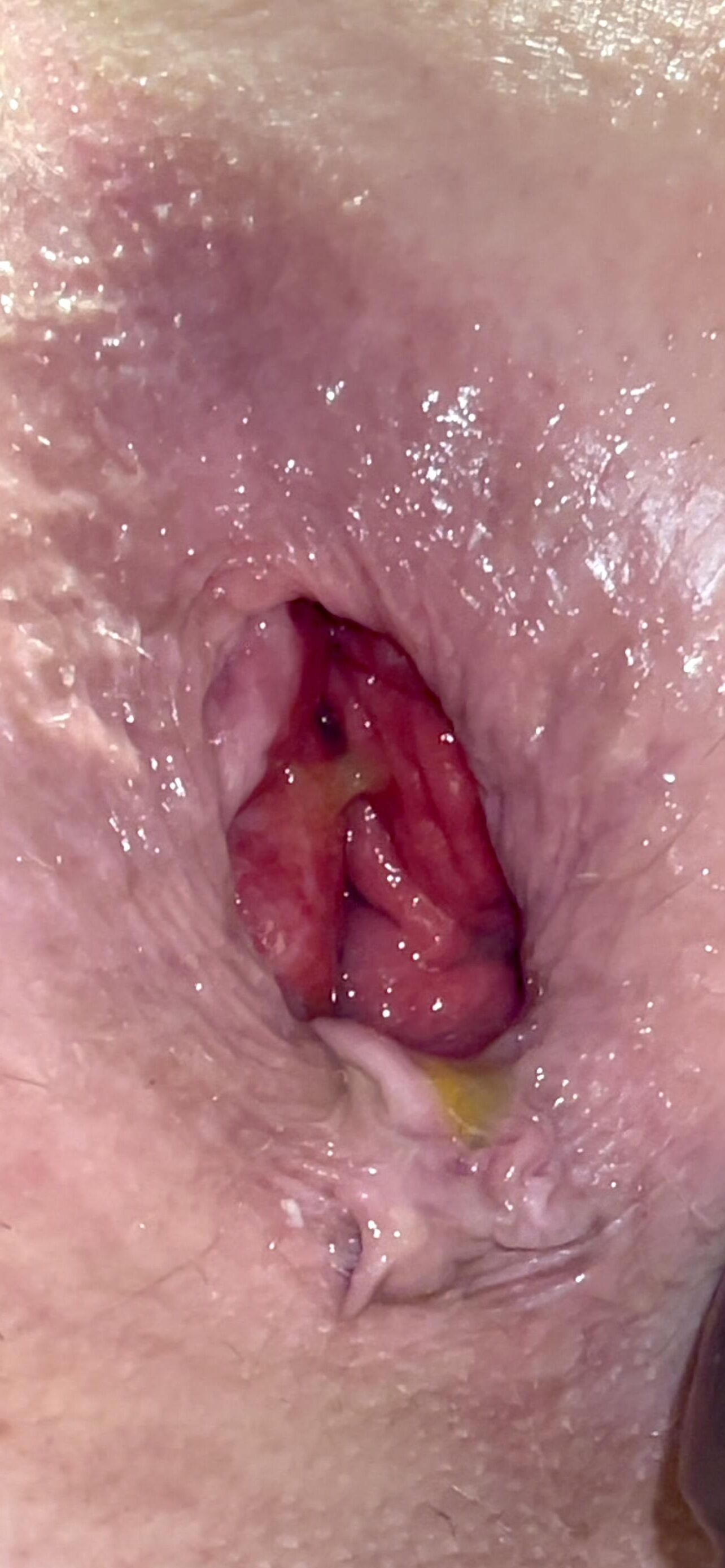 Meine Nahaufnahme anal Gape