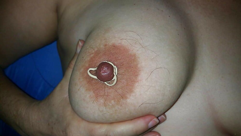 Poils aux Seins....