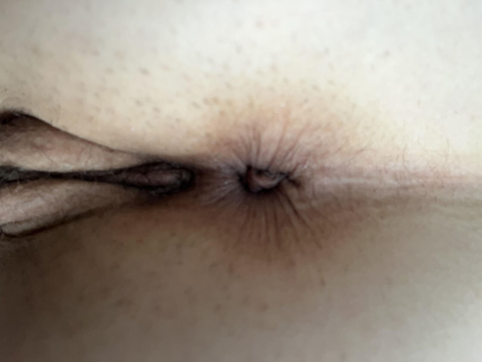Housewife Butthole Today (July st )