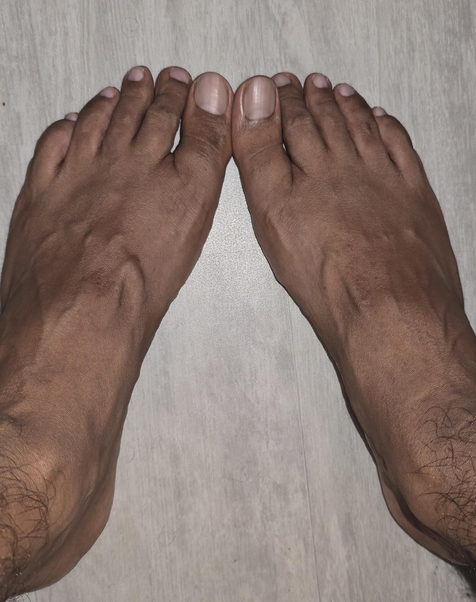 Pies naturales comestibles