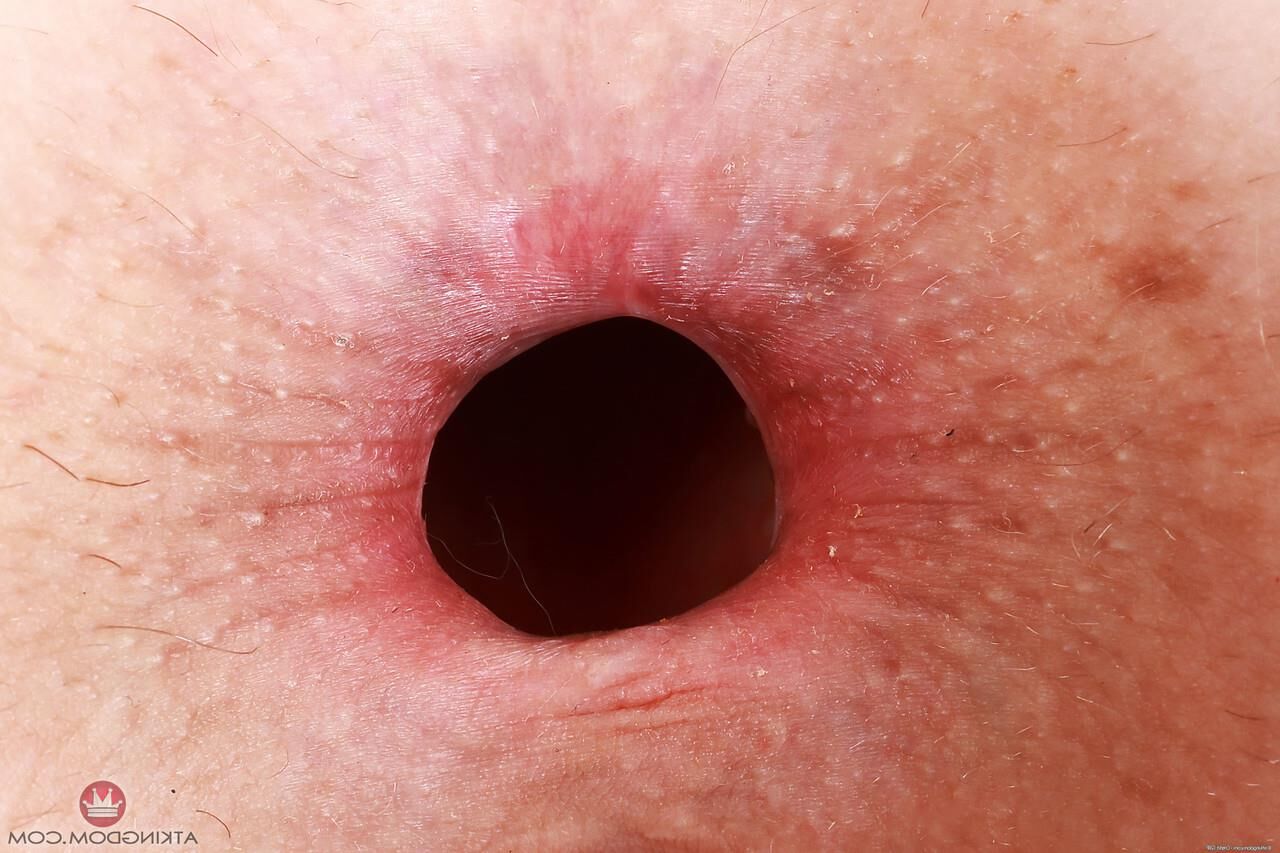 Holez escorrendo