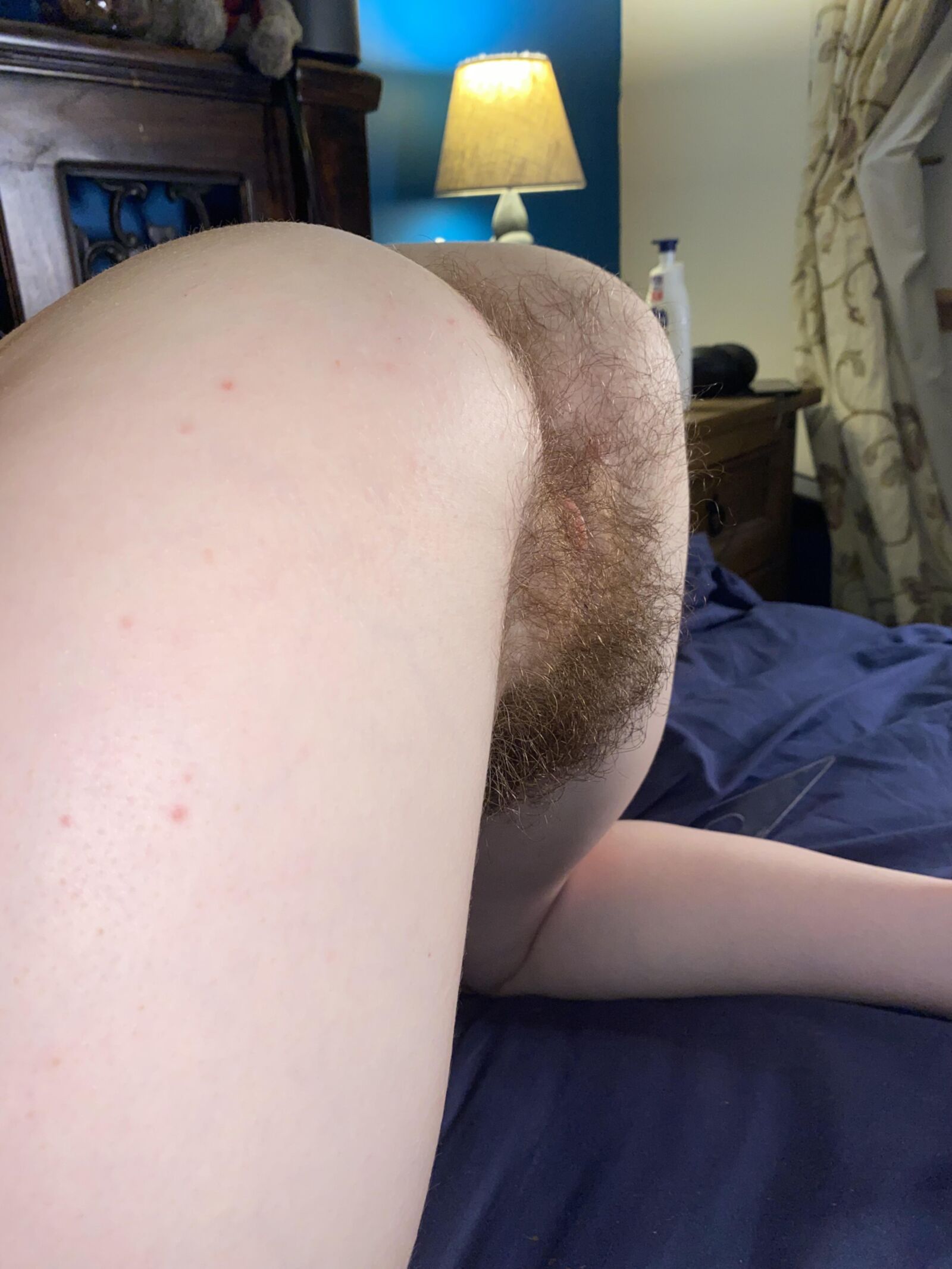 Hairy from the back 