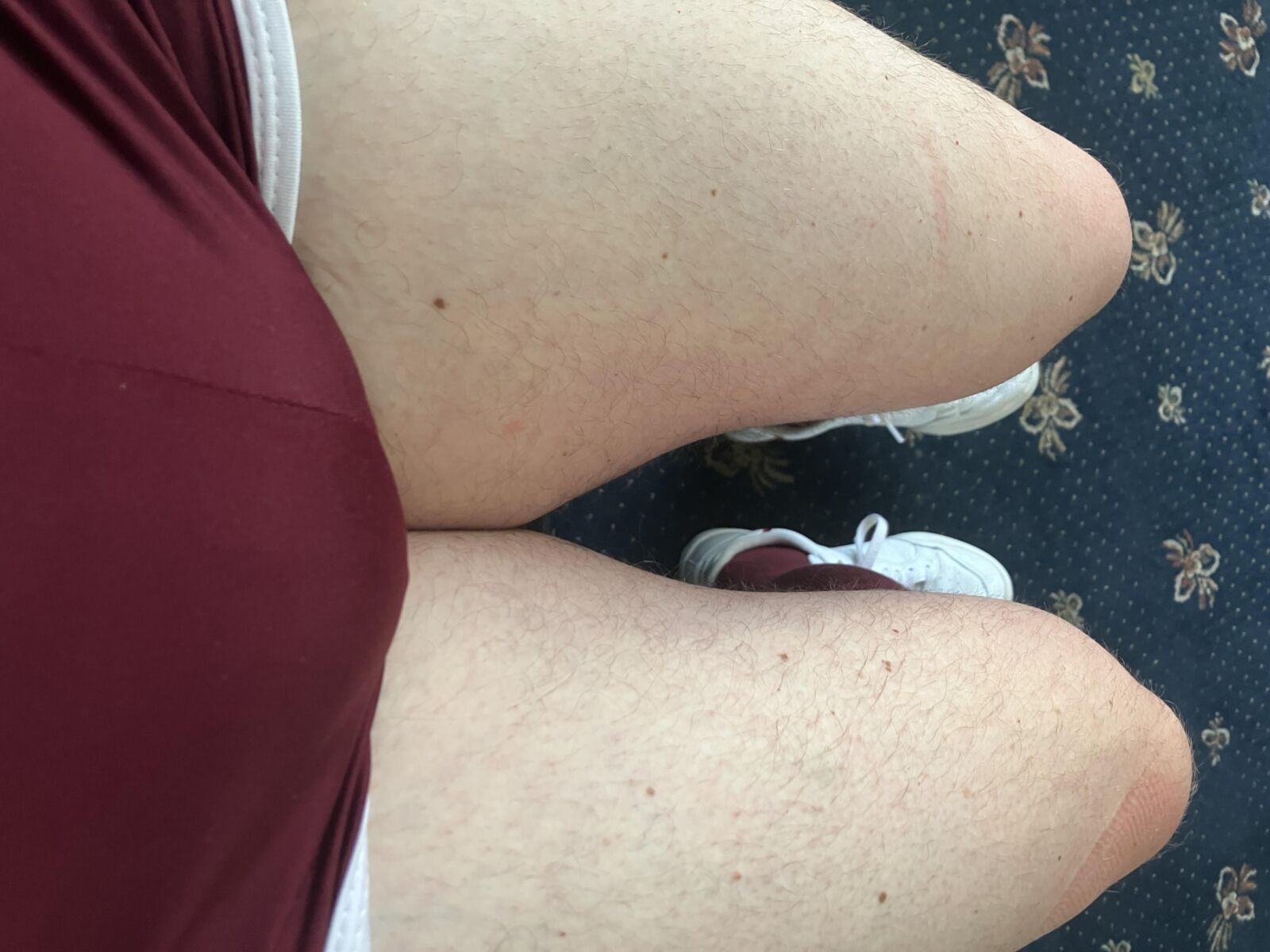 Pantalones cortos y bulto