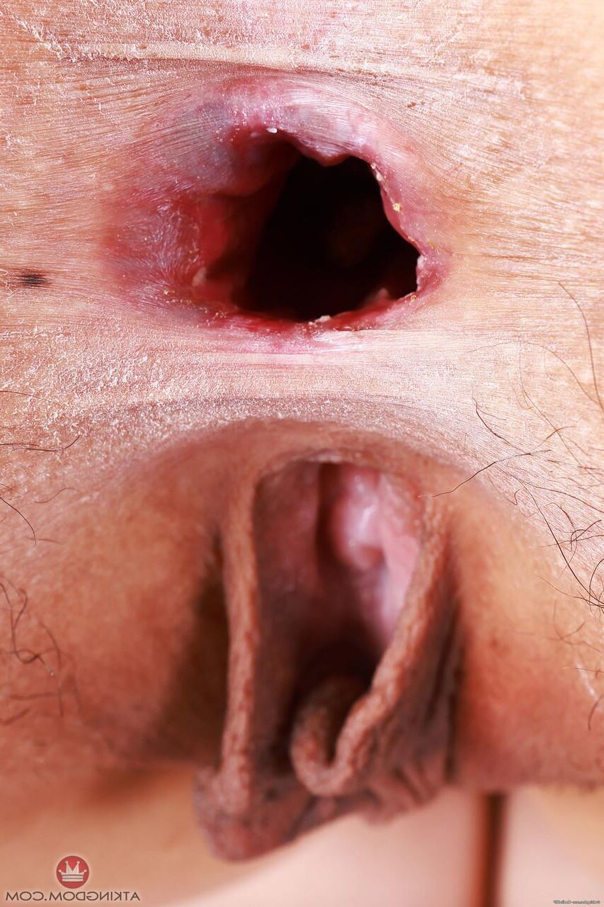 Holez escorrendo