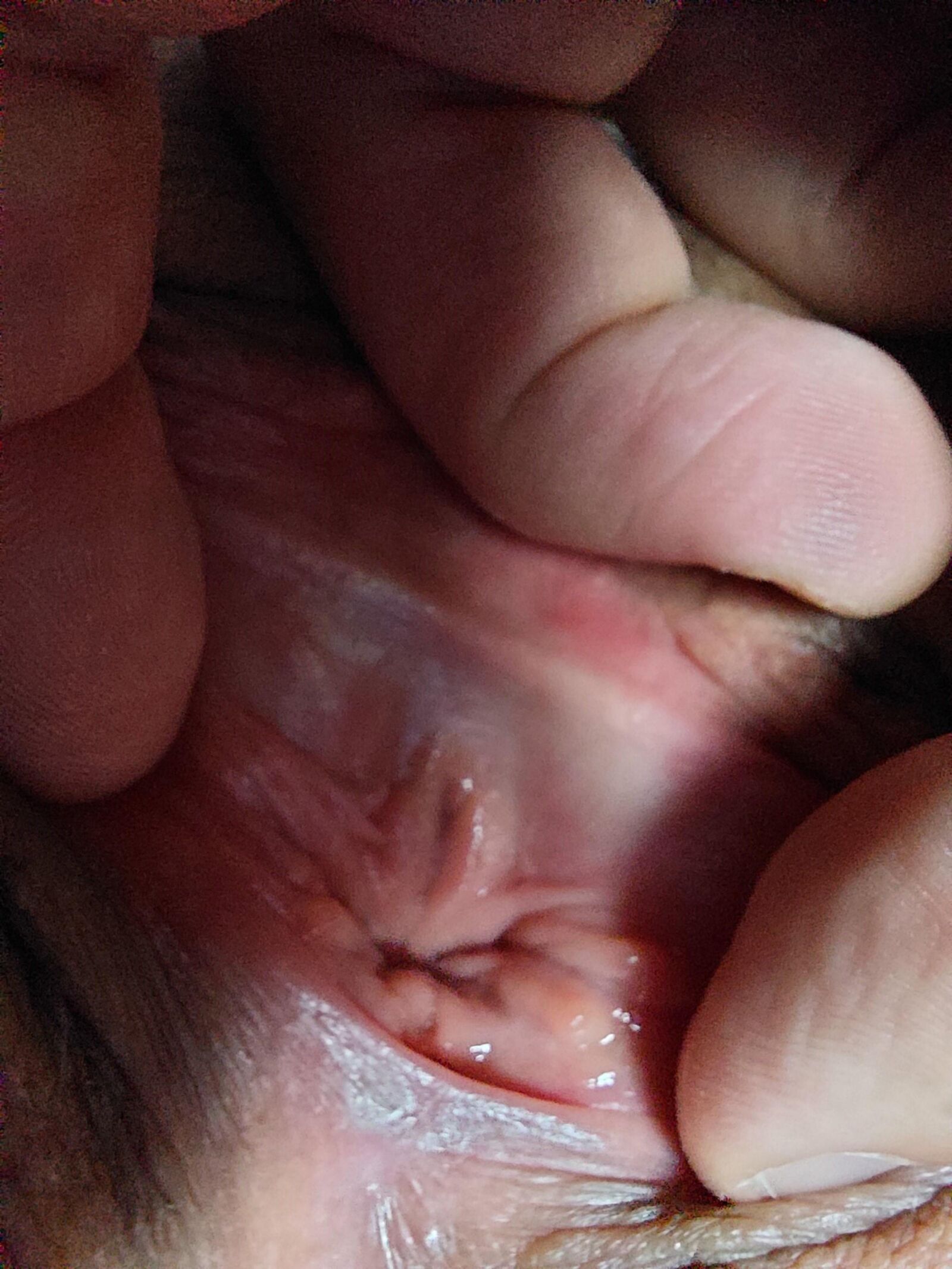 Fertiliser mon gros mollusque visqueux s'il vous plaît