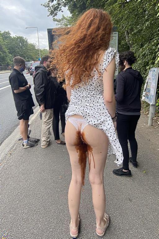AI accidents de caca quotidien (avertissement SCAT)