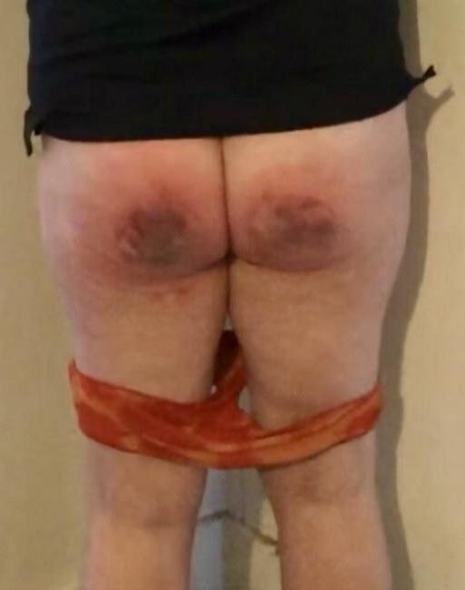 Colocando um pouco de calor na bunda dela