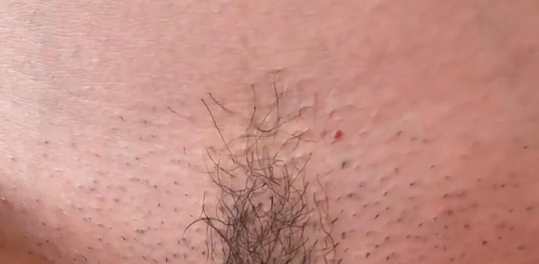 CHIVIDADES ELILIÁRIAS CXXXVII