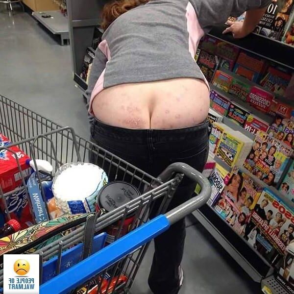 Butts Cracks